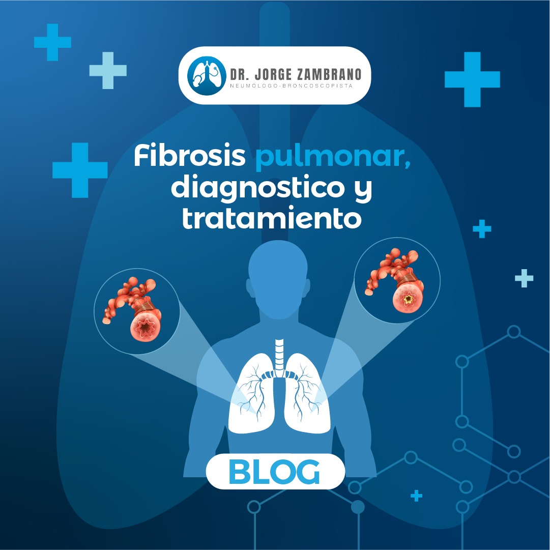 fibrosis pulmonar