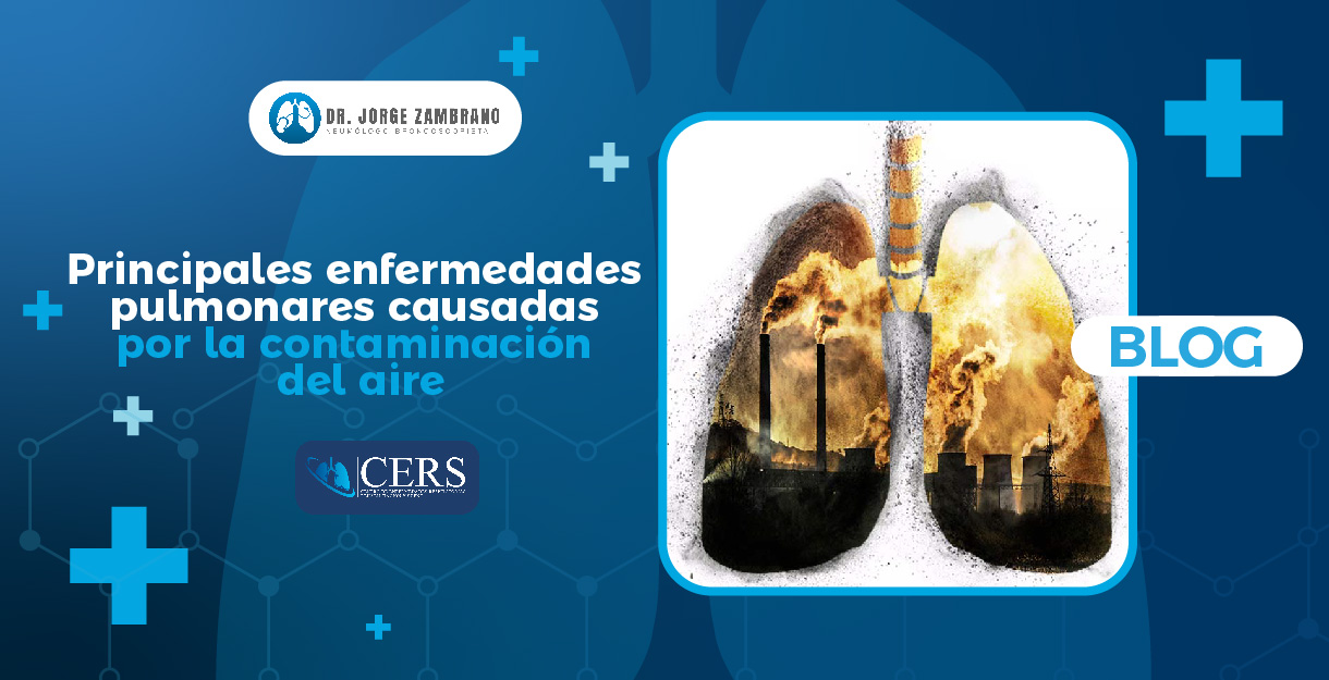 Enfermedades pulmonares